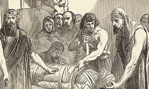 Thế kỷ 16 - 17, một số thầy thuốc, bác sĩ ở châu Âu sử dụng máu người, xương người, hay xác ướp nghiền thành bột để chữa nhiều bệnh từ đau đầu đến bệnh động kinh.