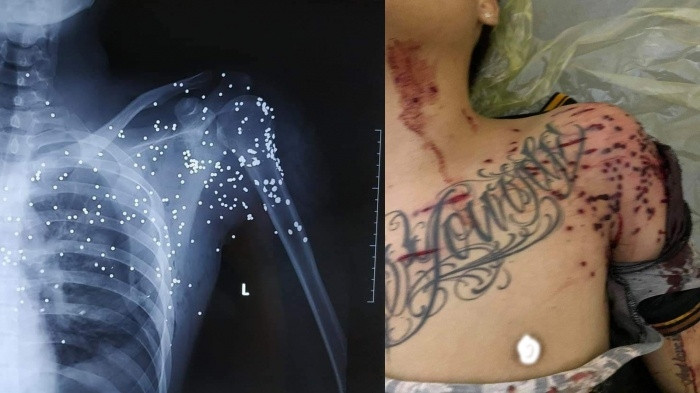 No sung tai tram thu phi Thanh Ne, Thai Binh: Nghi pham ra dau thu