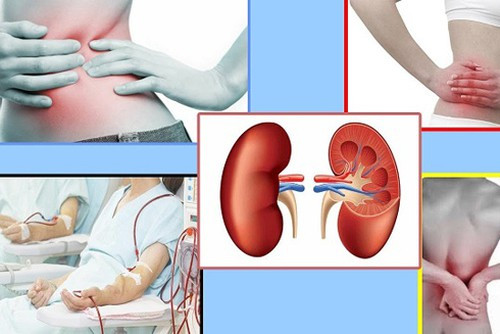 Dau hieu nhan biet co the bi suy than, tham chi la chua khoi u