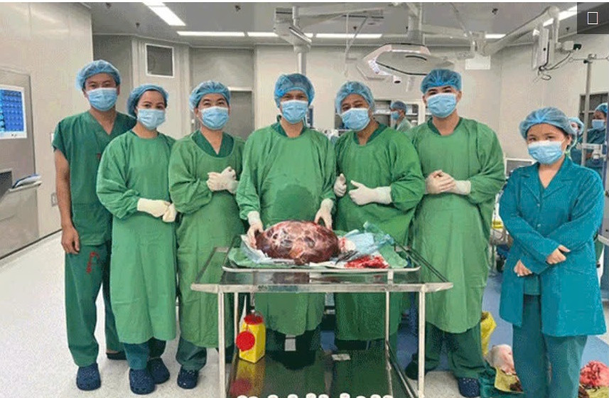 Phau thuat lay khoi u buong trung nang 15 kg cho mot phu nu