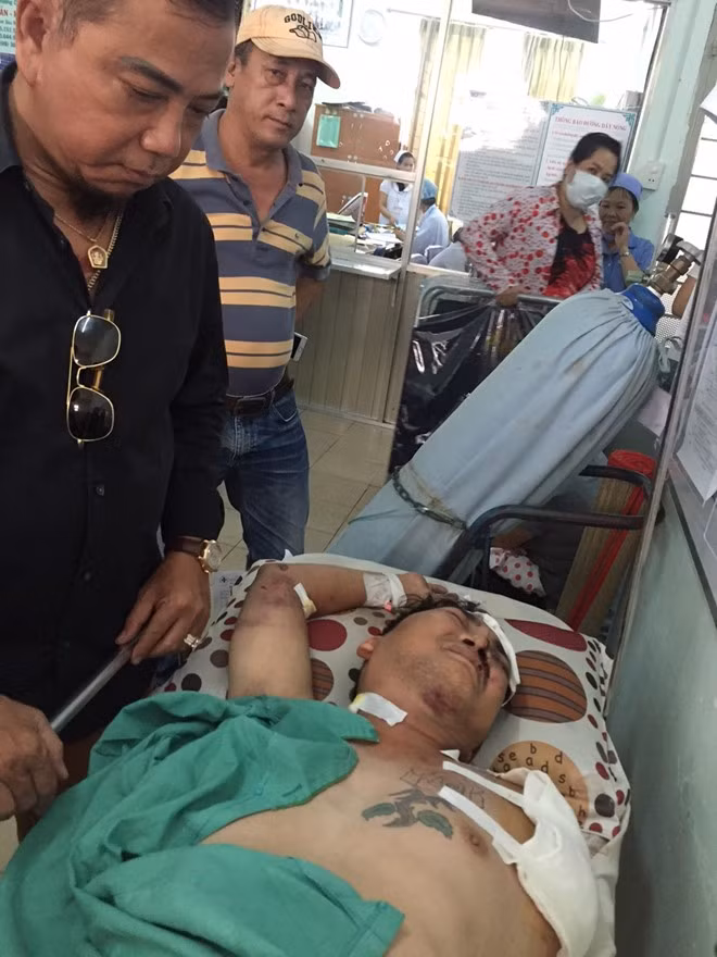 Ca si Nhat Linh bi tai nan mat mot canh tay