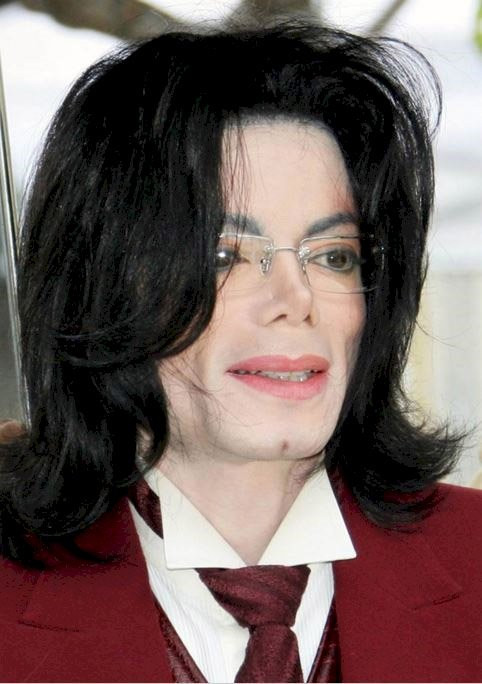 Thời điểm Michael Jackson xuất hiện ở Santa Monica - California năm 2005, phần cằm bị xẻ ở giữa, điều chưa từng xuất hiện trước đó.