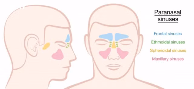  4. Xoang cánh mũi (paranasal sinus): Hay còn gọi là xoang bướm. Loại xoang này nằm rất sâu trong khoang mũi, ở vị trí cực kỳ hiểm hóc và khó xác định. Bởi vậy mà khi không may bị viêm nhiễm, các bác sĩ phải cần đến các phương pháp lâm sàng hiện đại như nội soi, chụp cắt lớp... mới có thể chẩn đoán chính xác được. Vấn đề là ở chỗ tác dụng của xoang bướm đến giờ này khoa học vẫn chưa thể nắm được. Rất nhiều người tỏ ra thắc mắc không hiểu sao cơ thể người lại có một hệ thống lằng nhằng, rắc rối mà lại dễ viêm nhiễm như thế. 
