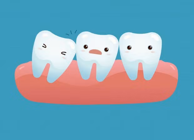  6. Răng khôn: Thời tiền sử, con người có một bộ cơ hàm tương đối lớn, nhằm xử lý các loại thức ăn cứng và nạp được nhiều calorie hơn, hỗ trợ cho quá trình sinh tồn. Sau này, loài người quen dần với những bữa ăn được nấu chín, ăn mềm hơn, nên bộ hàm dần nhỏ lại, và dĩ nhiên răng cũng ít đi. Tuy nhiên, hiện vẫn có ít nhất 5% dân số đang có những chiếc răng thừa. Chúng chính là răng khôn - thứ sẽ mọc ra vào một thời khắc nào đó của tuổi trưởng thành, và khiến bạn phải khổ sở. Dù vậy nếu theo đúng với Thuyết tiến hóa, thì trong tương lai có khả năng những chiếc răng này sẽ không còn xuất hiện nữa. Chỉ là không biết đến bao giờ thôi. 