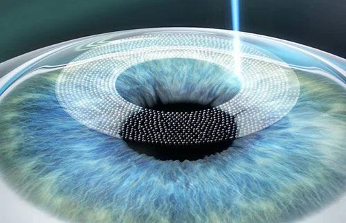 Kết quả mang lại ko hữu ích cho lắm, nhưng khoa học theo dõi mắt được phát triển dựa trên nó đã giúp ích rất to cho những thí nghiệm sau đó, giúp những ca phẫu thuật điều chỉnh thị lực LASIK mang thể thực hiện được. 