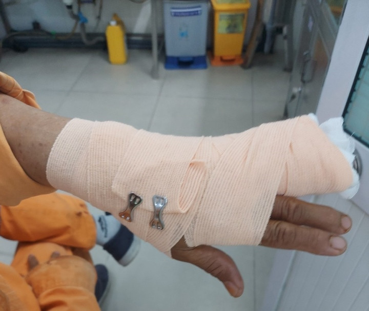  Đi nhắc nợ, nhân viên điện lực ở TP.HCM bị khách hàng đánh nhập viện: Ngày 28/9, đại diện Tổng Công ty Điện lực TP.HCM (EVNHCMC) xác nhận sự việc nam nhân viên chi nhánh điện lực Chợ Lớn trong quá trình đi nhắc nợ đã bị khách hàng hành hung dẫn đến thương tích. Cụ thể, sáng 24/9, nam nhân viên tên N. thuộc chi nhánh điện lực Chợ Lớn được phân công gửi thông báo nhắc nợ quá hạn thanh toán tại khu vực phường 15, quận 8. Khi đến địa chỉ địa chỉ số 10/59 đường Bình Đông, anh N. bị khách hàng tại địa chỉ trên dùng cây sắt cố ý hành hung. Nam nhân viên điện lực sau đó được đưa đi cấp cứu tại Phòng khám đa khoa Thuận Kiều với tình trạng đứt bán phần gân duỗi ngón 4, ngón 5 nên không gập, co duỗi, cử động được.