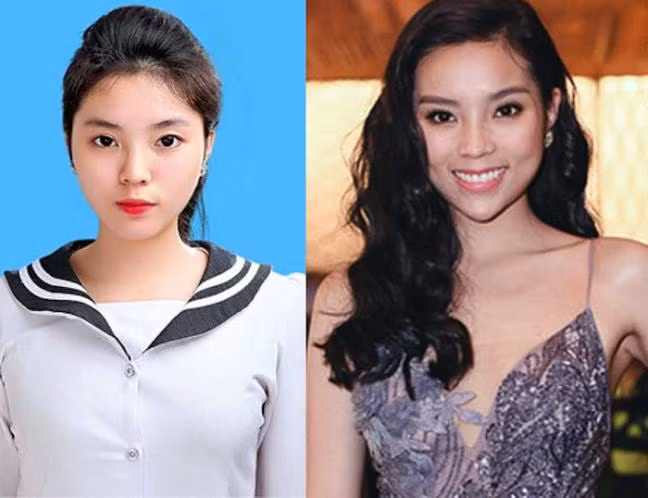 So với ảnh thời học sinh, nhan sắc Kỳ Duyên khác một trời một vực. Cô tuyên bố mình đã nhờ vào phương pháp bấm huyệt để có gương mặt thon gọn và chiếc cằm nhọn hơn.