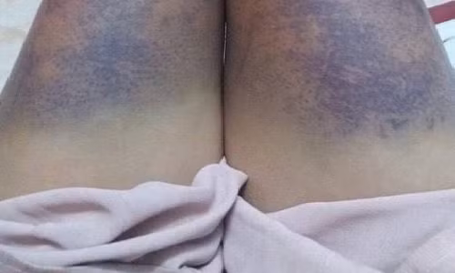 Hình ảnh Ngọc đăng lên mạng xã hội tố bạn trai hành hung. Ảnh: Facebook.