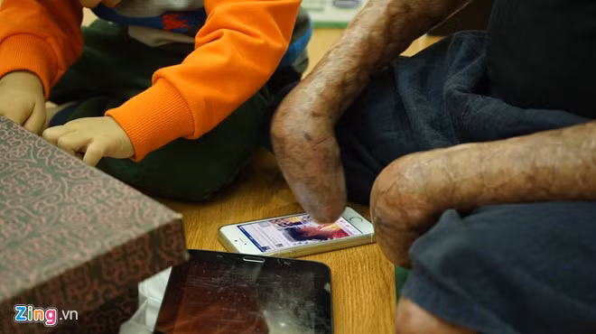 Anh Dương xuất ngũ tháng 9 và ra viện vào giữa tháng 12 năm nay. Trở về cuộc sống đời thường, anh sử dụng điện thoại di động, máy tính bảng để kết nối với bên ngoài. Để có thể làm những việc tưởng chừng đơn giản như ngồi, đọc báo, lướt web, uống trà,… anh Dương phải trải qua quá trình tập luyện phục hồi chức năng gian khó với sự nỗ lực không ngừng nghỉ. 