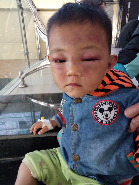 Kinh hoang be 2 tuoi bi cha duong danh tim bam mat