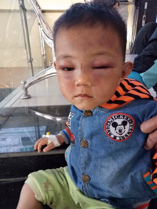 Kinh hoang be 2 tuoi bi cha duong danh tim bam mat