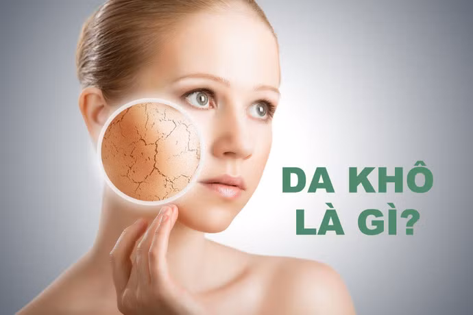 Bat mi nhung loai thuc pham tot cho da kho vao mua he