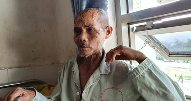 Nghi an gianh dat, cha gia bi rach nat dau: Cac ben noi gi?