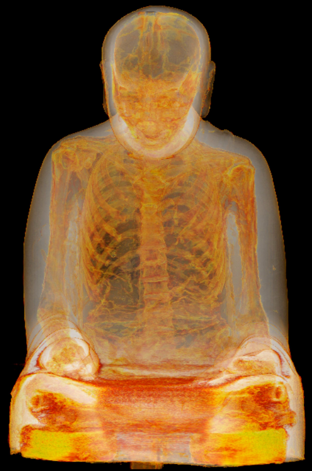 “Hình ảnh chụp cắt lớp cho thấy xác ướp là một người đàn ông từ 30 - 50 tuổi. Xác của ông được ướp và giữ trong một tu viện trước khi được bọc giấy và tráng men bên ngoài để hình thành bức tượng”, Wilfried Rosendahl, người đứng đầu chương trình nghiên cứu xác ướp của Đức tại Reiss-Engelhorn-Museen, cho biết.