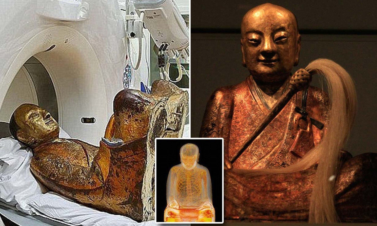 Kết quả kiểm tra của các chuyên gia cũng chỉ ra, thiền sư Trương Công Lục Toàn viên tịch khi khoảng 37 tuổi. Cơ thể của ông có dấu hiệu bị bệnh hoặc do chế độ ăn uống khắc nghiệt trong quá trình tự ướp xác gây ra.