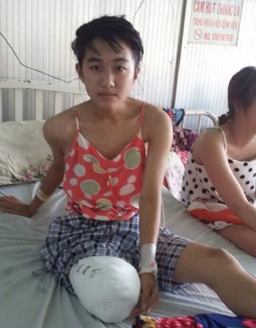 Tam dinh chi bac si tac trach khien nu sinh bi cua chan-Hinh-2