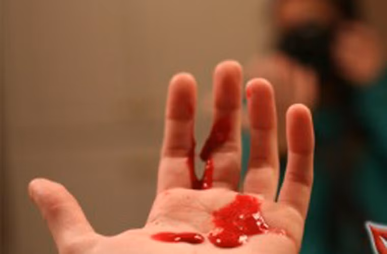 Kinh nghiệm chữa ung thư phổi của PGS Viện tim mạch Kinh nghiem chua ung thu phoi cua PGS Vien tim mach