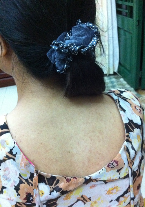 Kinh hai lay benh ve mau tu quan ao hang thung-Hinh-2