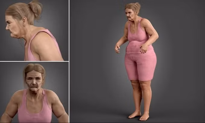 Những thay đổi này phần lớn xuất phát từ thói quen làm việc trên giường, một vị trí không phù hợp để làm việc trong thời gian dài.