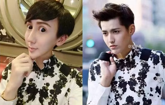 Lưu Tử Thần sinh năm 1996, hiện đang là người mẫu. Cố tình phẫu thuật thẩm mỹ để sở hữu gương mặt như nam thần, tuy nhiên ca phẫu thuật dao kéo bất thành, khuôn mặt của Lưu Tử Thần biến dạng nhọn hoắt, chiếc mũi thẳng tắp, cứng đờ, chàng trai này đã nhận được danh hiệu "nam thần mặt rắn".