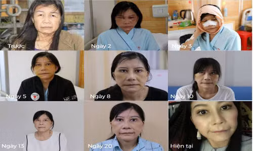 Dan mang sot xinh xich voi su “lot xac” cua co gai 22 tuoi-Hinh-2