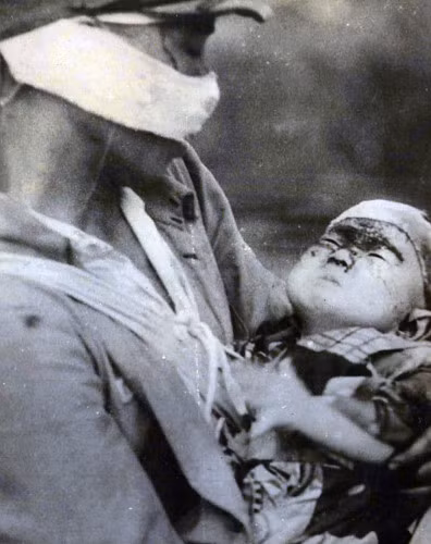 Vào thời điểm nửa năm sau vụ ném bom, một viên phi công Scotland tên là Fern đã có được loạt ảnh này sau khi mua lại một máy ảnh cũ của người đã chụp loạt ảnh.