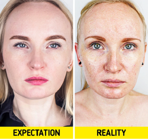 Dùng kem dưỡng chứa cồn giảm nhờn. Để giải quyết tình trạng da bóng nhờn, nhiều chị em gợi ý sử dụng sản phẩm chứa cồn. Thực tế, những mỹ phẩm chứa cồn mang lại hiệu quả làm khô da tức thì song có thể hủy hoại hệ vi sinh vật trên da, làm tổn thương hàng rào bảo vệ da.