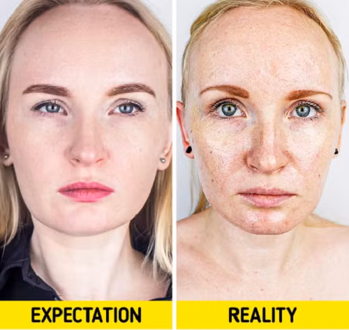 Dùng kem dưỡng chứa cồn giảm nhờn. Để giải quyết tình trạng da bóng nhờn, nhiều chị em gợi ý sử dụng sản phẩm chứa cồn. Thực tế, những mỹ phẩm chứa cồn mang lại hiệu quả làm khô da tức thì song có thể hủy hoại hệ vi sinh vật trên da, làm tổn thương hàng rào bảo vệ da.