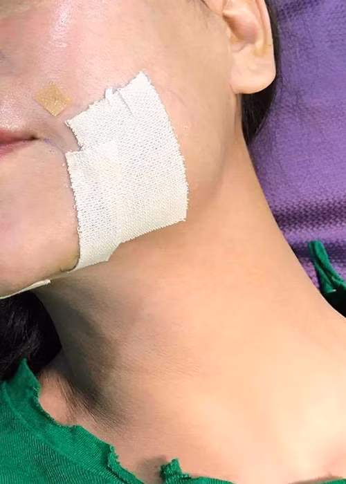 Tra Ngoc Hang dang anh mo hach khi bi nghi dao keo-Hinh-3