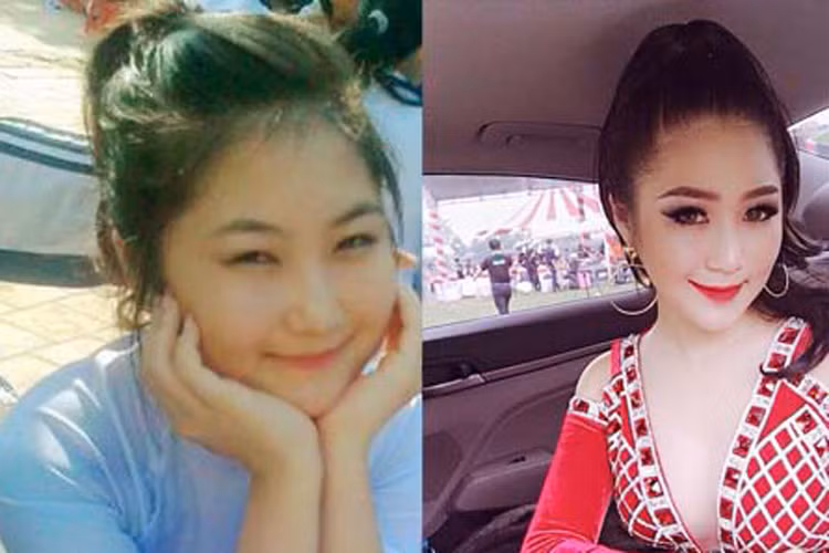 Huong Tram lieu co giong Huong Ho, nghien phau thuat tham my?