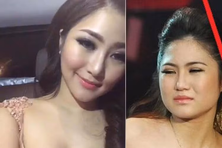 Lúc này, clip phẫu thuật thẩm mỹ bị rò rỉ, Hương Tràm thừa nhận sửa mũi vì tướng số.