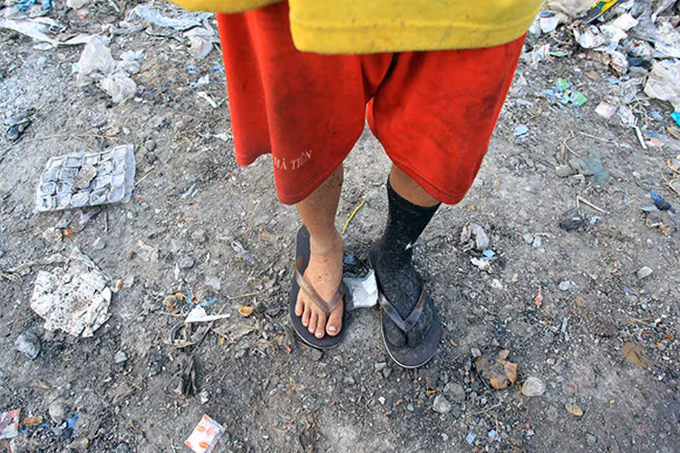 Tuấn cho biết em vừa bới được một chiếc tất còn nguyên vẹn trong đống rác và nhanh chóng đi vào chân. Rất nhiều lần em đã bị mảnh chai, miếng sắt cứa rách chân trong lúc bới rác.