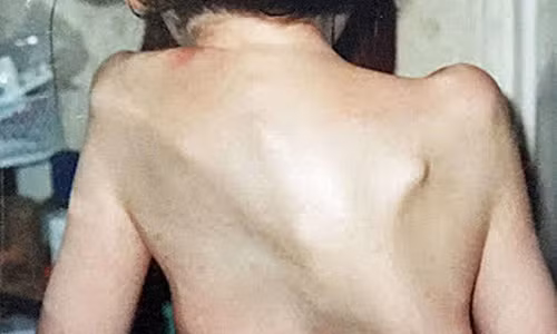 Co gai 23 tuoi cung luc nuoi 2 bo xuong tren nguoi-Hinh-2