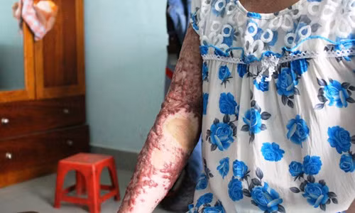 Noi dau cua nguoi me trong vu an tra thu tinh bang xang-Hinh-2