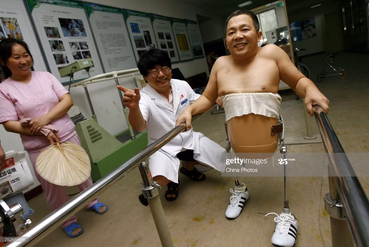 Peng Shuilin miệt mài tập đi và hạnh phúc khi có thể di chuyển với đôi chân mới. Ảnh: Getty.