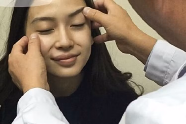 Tuy nhiên, theo một bác sĩ thẩm mỹ hàng đầu Đài Loan tên Tạ Đông Dĩnh, kết quả phim chụp cắt lớp của bà xã Huỳnh Hiểu Minh cho thấy sống mũi của cô có vật lạ, nhô hẳn lên, dấy lên nghi vấn nữ diễn viên đã nâng mũi.