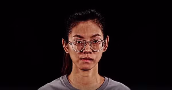 Trước khi bước vào cuộc phẫu thuật thẩm mỹ, cô gái Thái Lan có một làn da ngăm đen, sần sùi, khuôn mặt không cân đối, hàm lệch, miệng bị méo sang bên phải, hàng lông mày thi nhau mọc vô tổ chức.