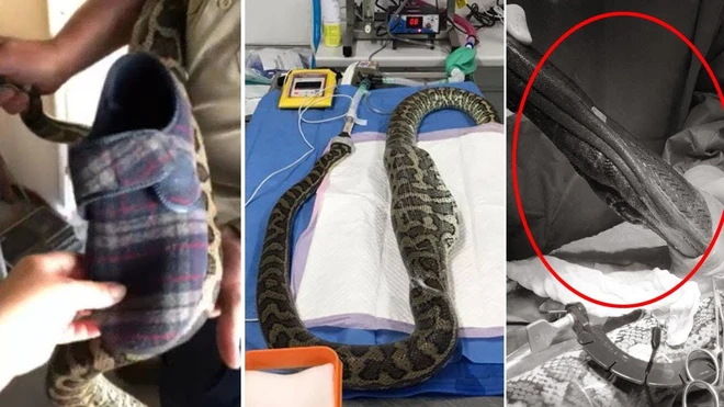 Nếu con trăn không được phẫu thuật, chiếc giày không thể tiêu hóa sẽ gây ra các vấn đề nghiêm trọng như bệnh dạ dày, nhiễm trùng hay loét dạ dày. Sau khi lấy vật thể lạ ra thành công, con trăn đã hồi phục sức khỏe.(Ảnh: HerpVet)