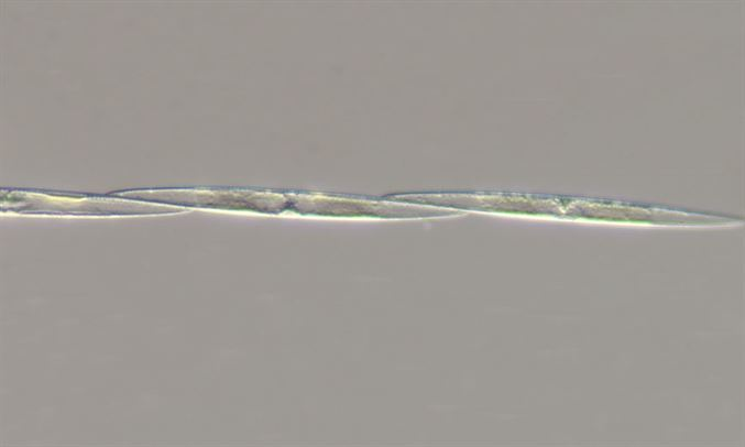 Các nhà khoa học đã công bố một phát hiện quan trọng về hai loài tảo biển tí hon có khả năng gây mất trí nhớ, Pseudo-nitzschia pungens và Pseudo-nitzschia brasiliana, trong vùng biển Philippines. Đây là một thông tin đáng chú ý, bởi những loài tảo này có khả năng sản sinh ra axit domoic, một chất độc thần kinh nguy hiểm. (Ảnh: Marine Biodiversity Portal of Bangladesh)