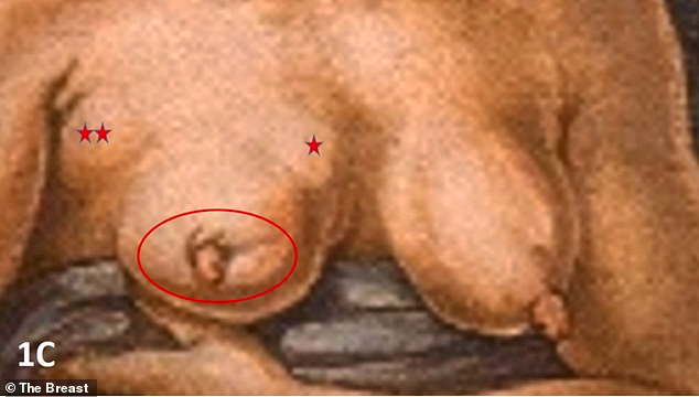 Michelangelo không chỉ tạo ra các tác phẩm nghệ thuật với ý nghĩa tôn giáo và triết học mà còn gửi gắm kiến thức y học. Michelangelo đã học về giải phẫu từ năm 17 tuổi và có thể đã gặp bệnh nhân ung thư vú, điều này ám ảnh ông suốt đời. (Ảnh: The Breast)