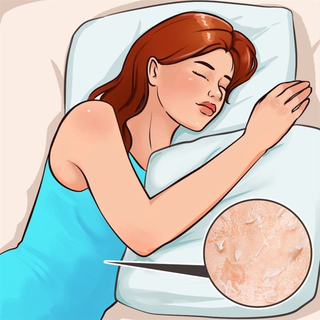 Bộ đồ ngủ thường áp sát vào làn da của bạn. Nếu bạn tiếp xúc với cùng một tấm vải nhiều lần, vi khuẩn và tế bào da chết sẽ tích tụ trong quần áo của bạn. Ngay cả khi bạn thường xuyên giặt ga giường, nó cũng sẽ không còn mới trong thời gian dài vì tiếp xúc trực tiếp với quần áo ngủ chưa giặt. Việc mặc cùng một bộ đồ ngủ đêm này qua đêm khác có thể gây ra nhiễm trùng khó điều trị.