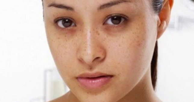 4 thu nay tham den... de mac benh nguy hiem, co 1 cung nen di kham-Hinh-2