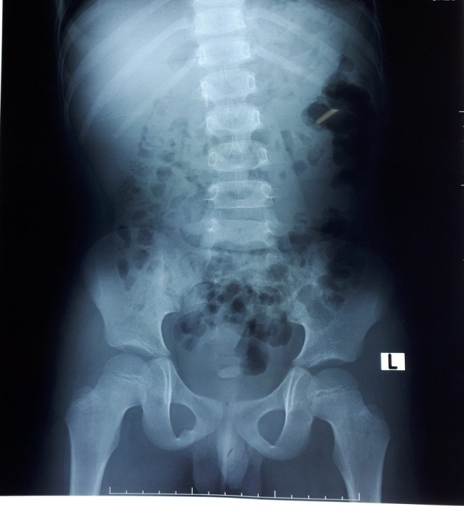 Bac Giang: Me “ta hoa” khi than con trai 8 tuoi day soi