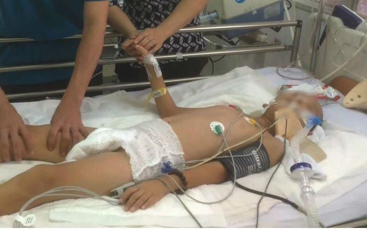 Do tủy sống bị tổn thương dẫn đến bệnh nhi bị liệt hai tay, phổi mất chức năng hô hấp nên phải thở máy. (Ảnh: Vietnamnet).