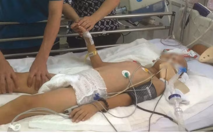 Do tủy sống bị tổn thương dẫn đến bệnh nhi bị liệt hai tay, phổi mất chức năng hô hấp nên phải thở máy. (Ảnh: Vietnamnet). Do tủy sống bị tổn thương dẫn đến bệnh nhi bị liệt hai tay, phổi mất chức năng hô hấp nên phải thở máy. (Ảnh: Vietnamnet).