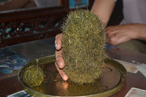 Trong đó, 1 cục to nặng 0,8 kg nằm trong dạ dày, dài gần 18cm, đường kính khoảng 8cm; 1 cục nhỏ 0,1 kg trong túi mật.