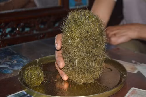 Trong đó, 1 cục to nặng 0,8 kg nằm trong dạ dày, dài gần 18cm, đường kính khoảng 8cm; 1 cục nhỏ 0,1 kg trong túi mật.