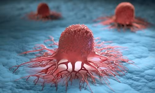 Khi tế bào ung thư lan rộng, cơ thể phát những tín hiệu này Khi te bao ung thu lan rong, co the phat nhung tin hieu nay