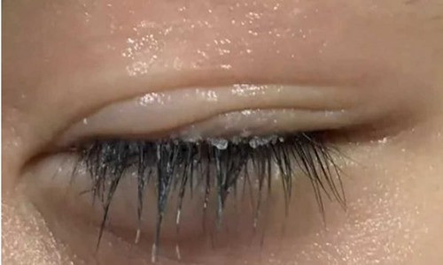 Me lam dieu nay voi con trai, bac si quat to: Suyt thi mu