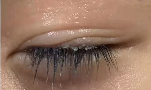 Me lam dieu nay voi con trai, bac si quat to: Suyt thi mu